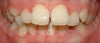 Large, Protruding front teeth