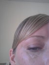 Bump on lower edge