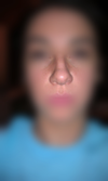 frontal view