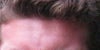 it doesnt look here exactly in this photo i had made a funny face but you can see the problem clearly...