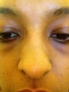 Frontal view of my nose