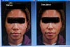 Before / and the very bad Simulation.