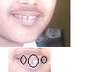 this my teeth pic i know its not so clear ...its a fb pic