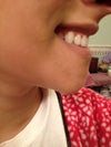 bottom half of mouth seems to "jut" out