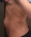 Lower belly pouch!