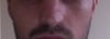 Appearance of my right nostril now.