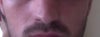 Left nostril now for comparison