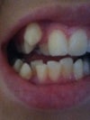 Teeth