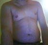 Central Obesity