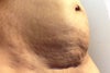 My belly now :(