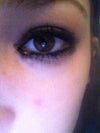 This is my better eye