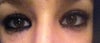As you can see my one eye is more hooded and they look uneven