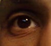 Two deep lines under eye.