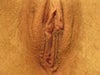 Notice the sutures on the your left side. could the have separated from each other which may be causing the left to look lower?