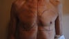 Before surgery