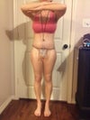 Dec 27 13 day post op