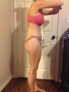 Dec 27 13 day post op