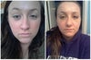 Before is left, After (day 9) is right.