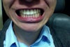 My teeth