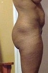 Some stomach pouch