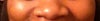 Wide spread nose