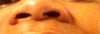Wide spread nostrils