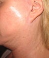 Sagging neck, pixie ears