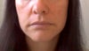 Jowls and frown