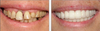 Cosmetic Dentistry Before and After Photos