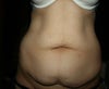 close up stomach