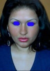 Frontal view