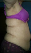 stomach/back