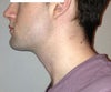3rd photo, jaw pushed out.