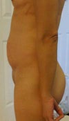 Left View 1