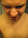 Showing the large tip of my nose when I smile.
I