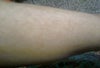 arm pic front side
