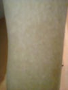 arm pic back side