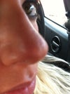 Looks indented/scarred...I'm not sure?