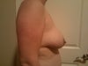 Side Breast