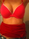 loss of cleavage in right breast