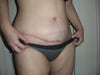 There is really nothing to "see" but the pain is in my upper abdominal area.