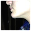 Side profile of chin.