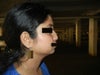 my right profile, depressed nose , receded chin and fluffy cheeks