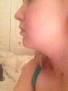 Left side