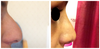 Before and After! the profile is also amazing.
