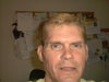 One day before unauthorized Juvederm (or possibly Radiesse) injections under both eyes.