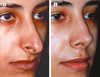 picture of nose
