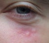 white spots