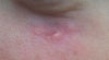 white spots