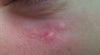 white spots